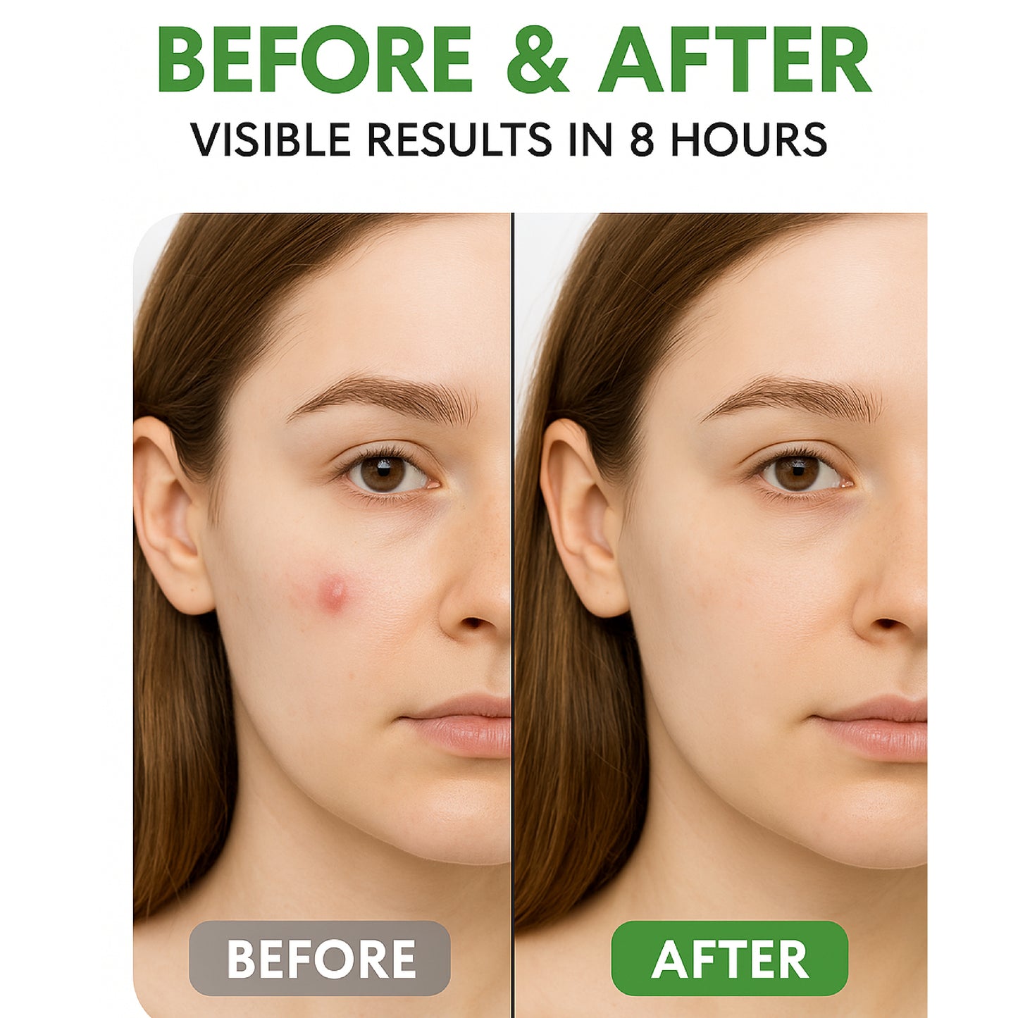Naturva ClearDot Acne Patches for Face – 36 Hydrocolloid Pimple Patches | Fast Healing, Invisible Zit Stickers for Overnight Blemish Care | Protects from Dirt & Absorbs Impurities – 12mm Waterproof Spot Patch